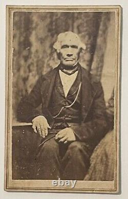 Elderly African American Man with Clubbed Hand 1860s CDV Carte de Visite Photo