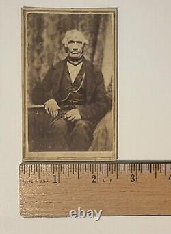 Elderly African American Man with Clubbed Hand 1860s CDV Carte de Visite Photo